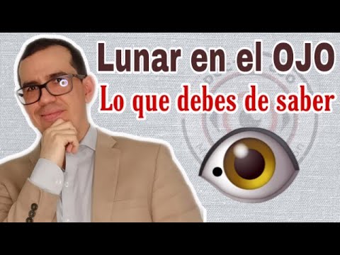 Descubre el significado espiritual del lunar en el iris ocular